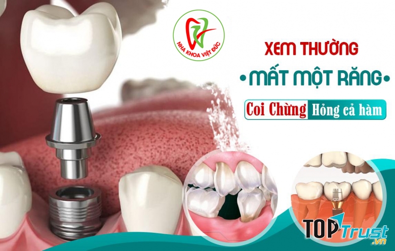 Nha Khoa Việt Đức