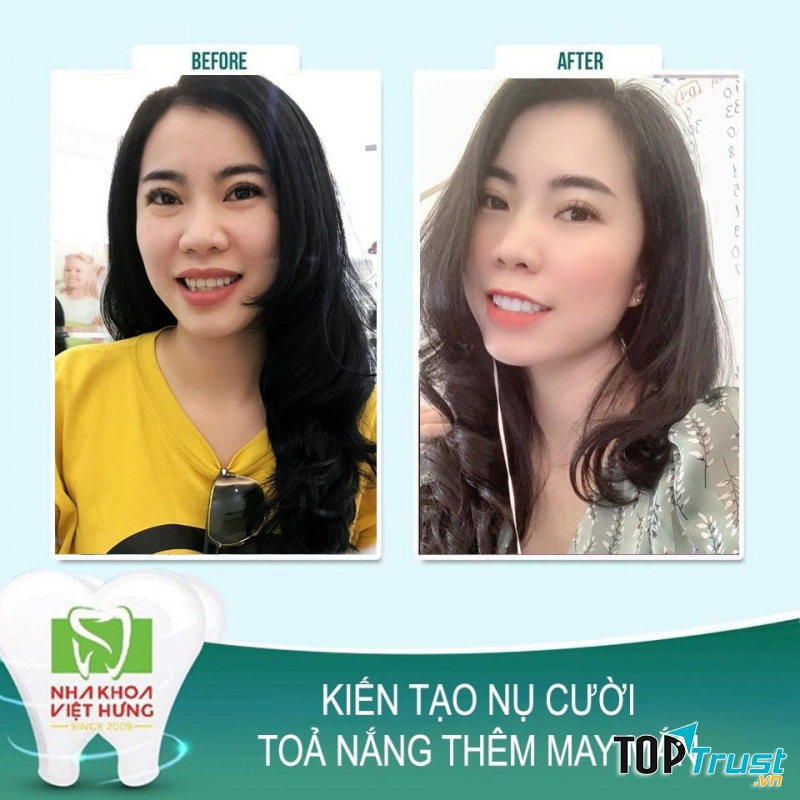 Nha Khoa Quốc Tế Việt Hưng