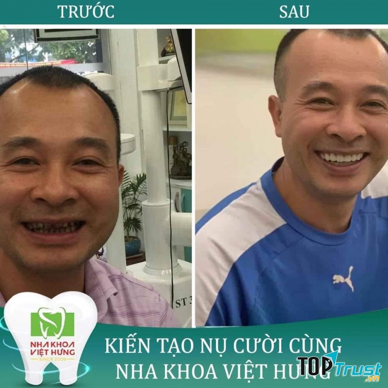 Nha Khoa Quốc Tế Việt Hưng