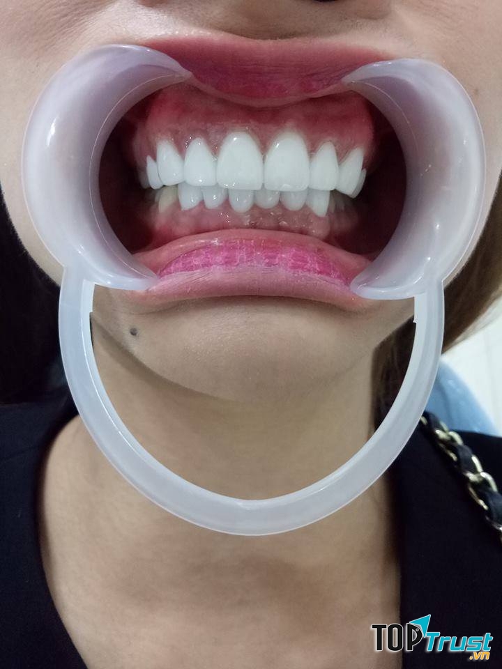 Nha Khoa Việt Mỹ