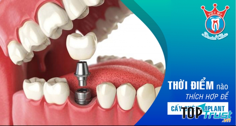 Nha khoa Việt Mỹ