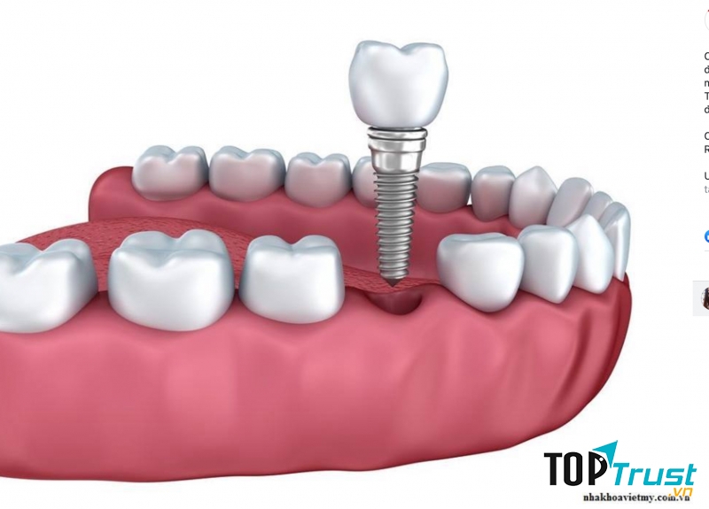 Nha khoa Việt Mỹ