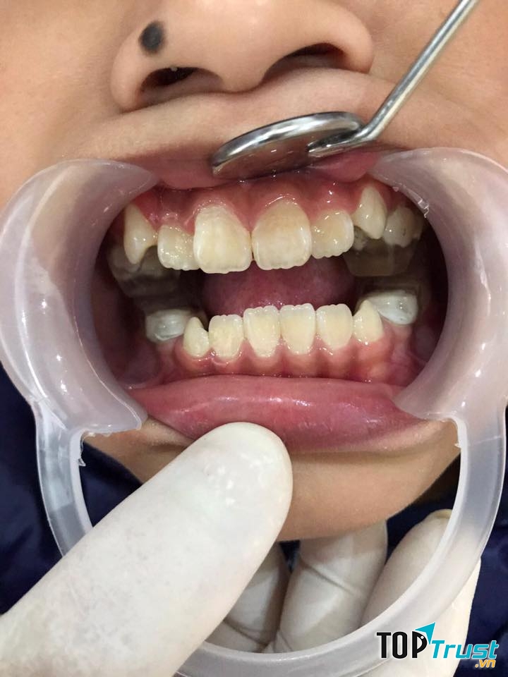 NHA KHOA VIỆT MỸ