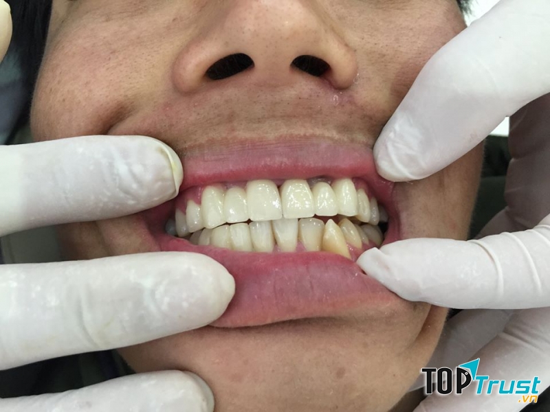 NHA KHOA VIỆT MỸ