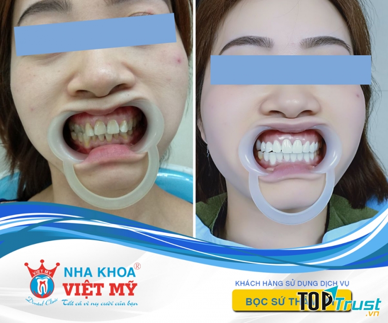 Nha Khoa Việt Mỹ