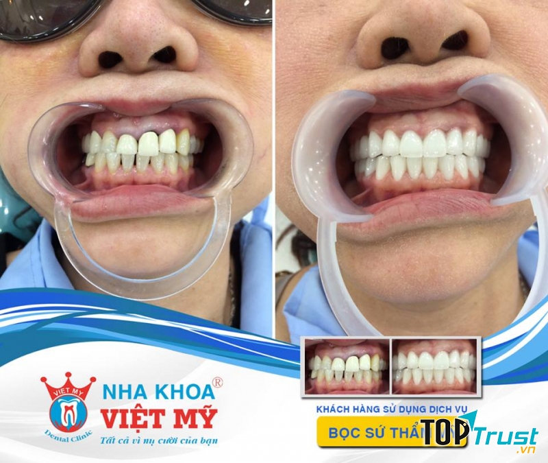 Nha Khoa Việt Mỹ