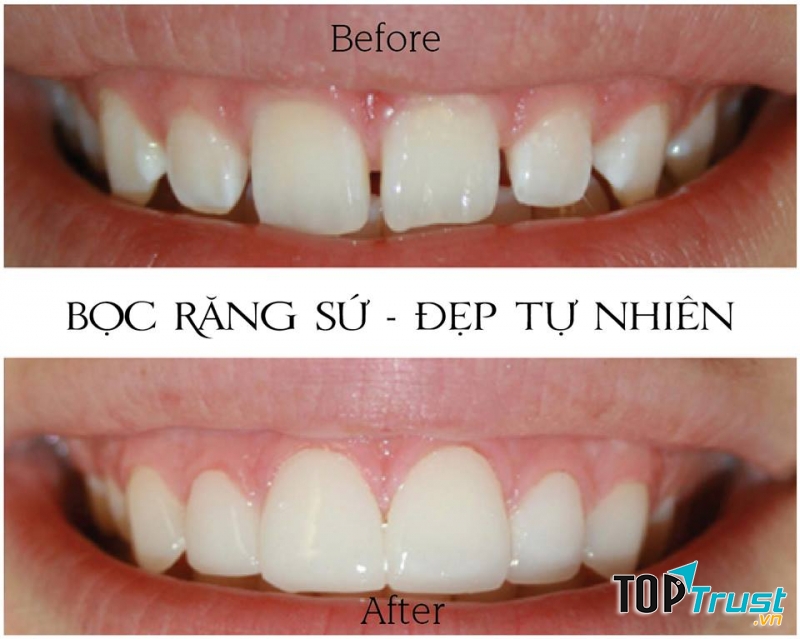 Nha khoa Việt Mỹ