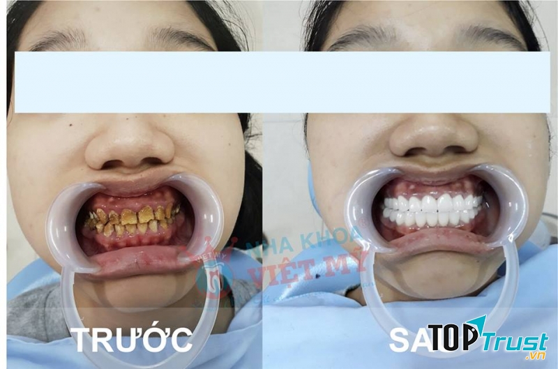 Nha khoa Việt Mỹ