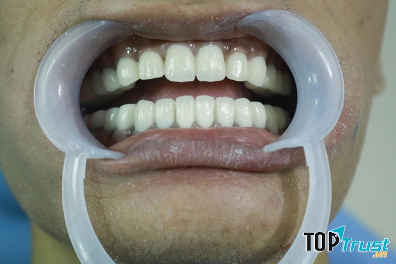 Nha Khoa Việt Mỹ - Quảng Bình