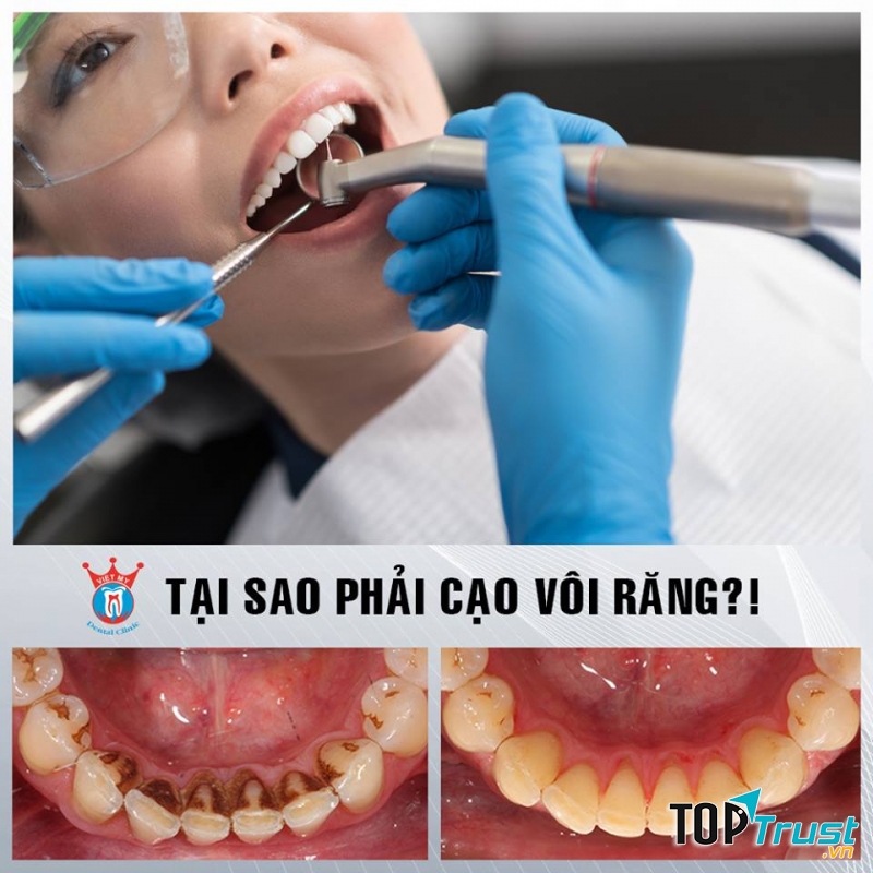 Nha Khoa Việt Mỹ - Tuy Hoà