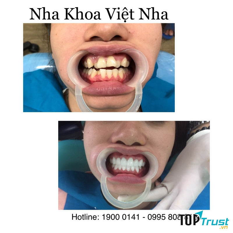 Nha Khoa Việt Nha