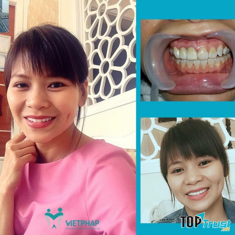 Nha Khoa Việt Pháp