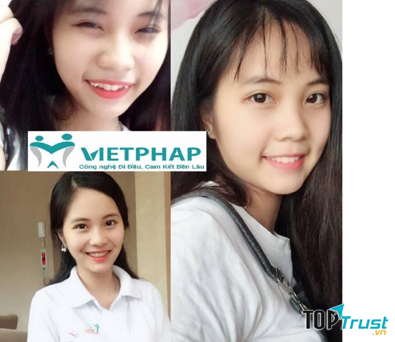 Nha Khoa Việt Pháp