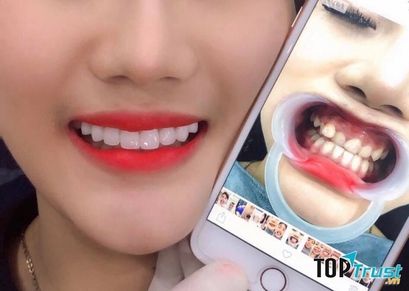 Nha khoa Việt Pháp