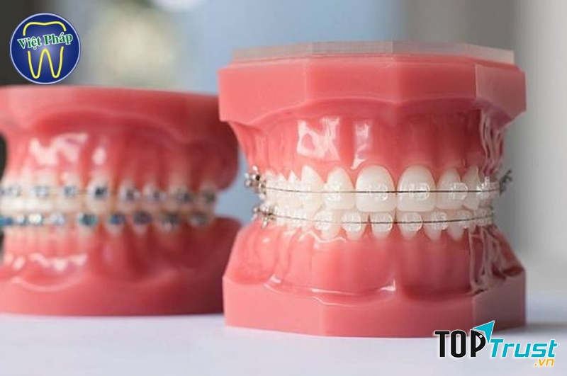 Nha Khoa Việt Pháp