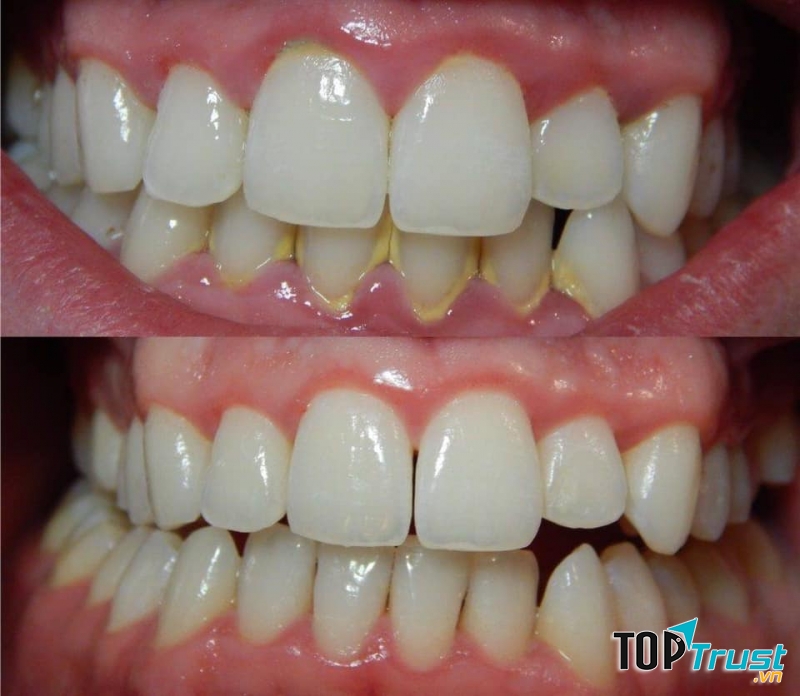 Nha Khoa Việt Tiệp Tuyên Quang