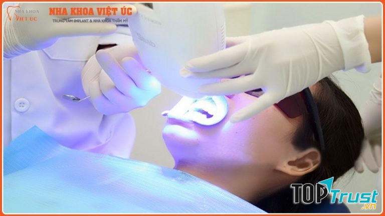 Công nghệ tẩy trắng hiệu quả, an toàn tại nha khoa Việt Úc
