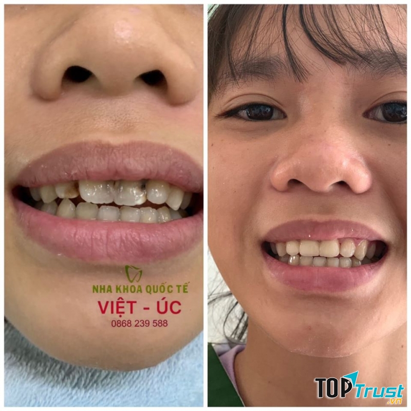 Nha Khoa Việt Úc