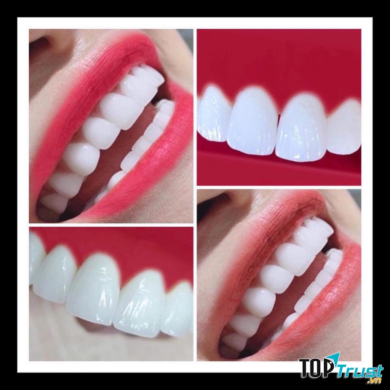 Nha Khoa Xinh Xinh - TP  Quảng Ngãi