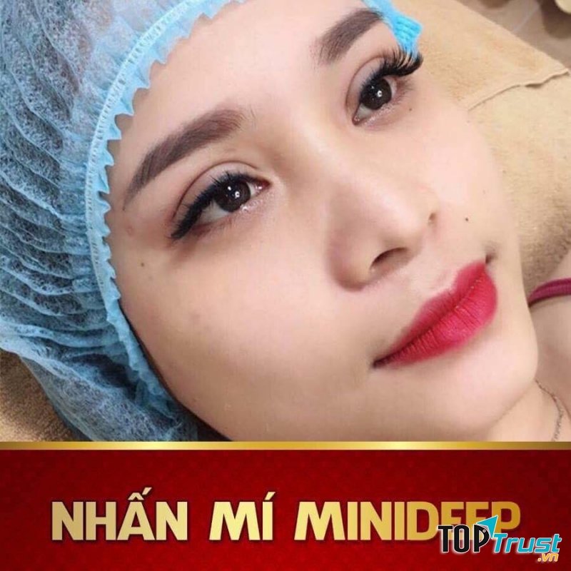 Nhấn mí Hồ Ly