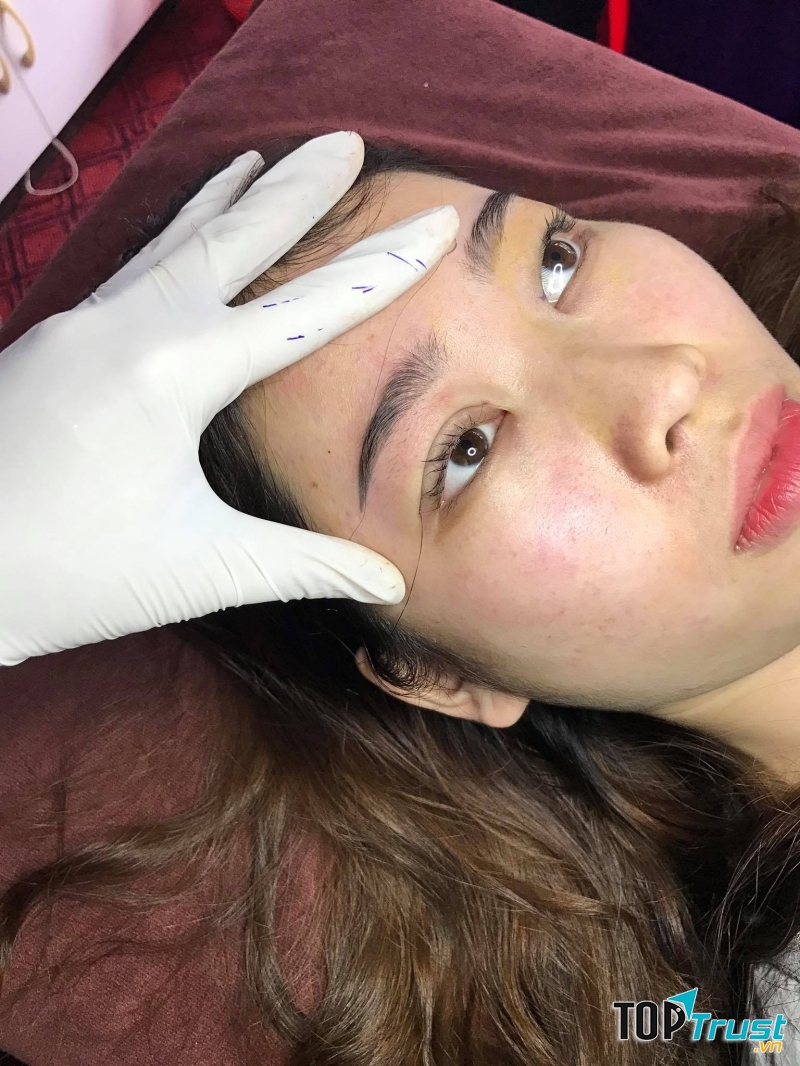 Nhấn Mí Thảo Ann