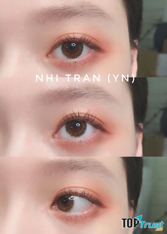Nhi Tran Contact Lens