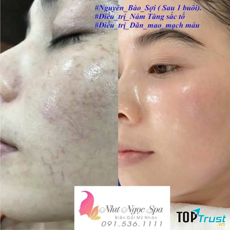 Như Ngọc Spa - Spa Uy Tín Hàng Đầu