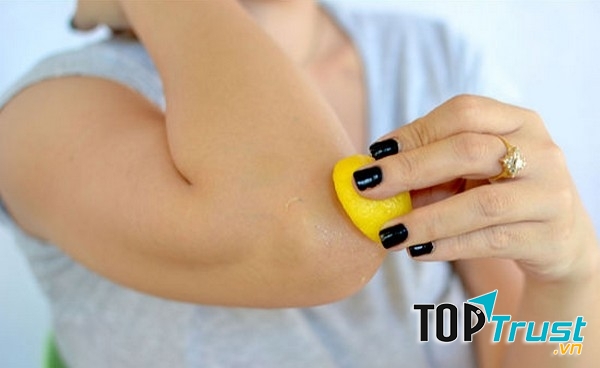 Những nốt vàng xung quanh mắt và khuỷu tay