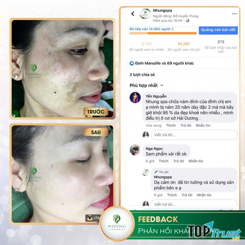 Nhung Spa - Hưng Yên