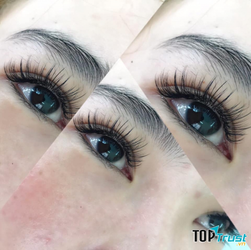 Nối mi Nguyễn Su