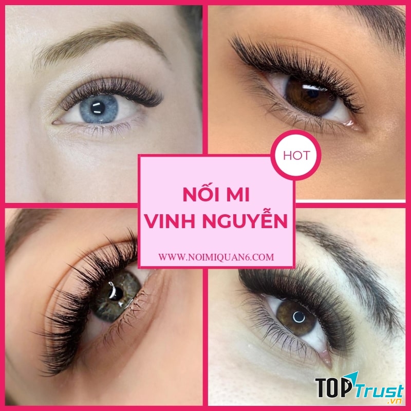 Nối mi Vinh Nguyễn