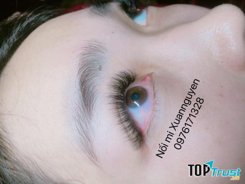 Nối Mi Xuan Nguyen