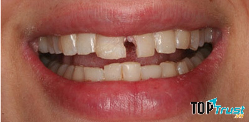 Ảnh minh họa - nguồn internet