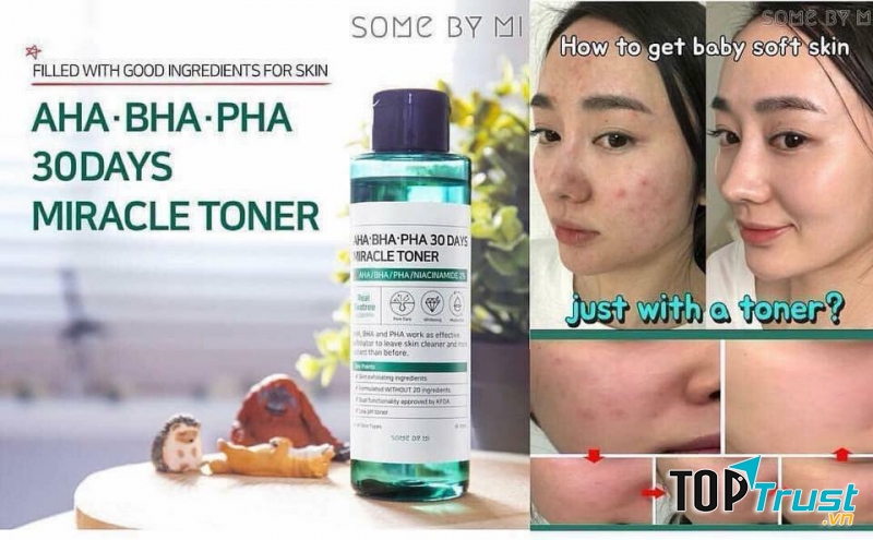 Nước hoa hồng trị mụn Some By Mi AHA-BHA-PHA 30 Days Miracle Toner 150ml.