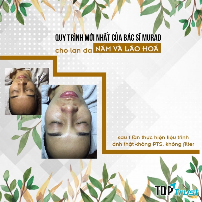 Oanh Beauty Spa