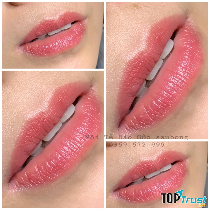 OANH BeautyCenter