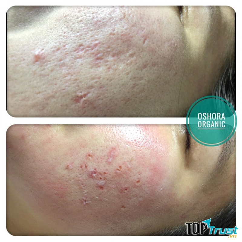 Oshora Organic Clinic & Spa