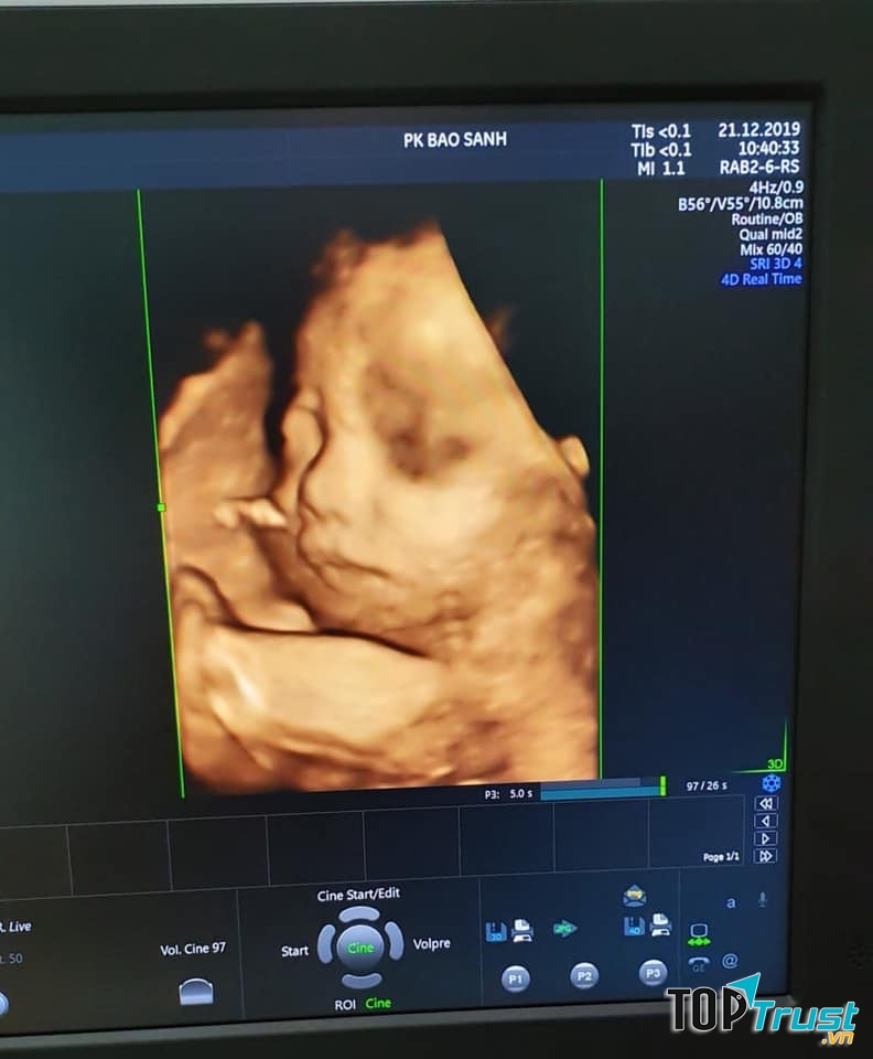 Phòng Khám Bảo Sanh