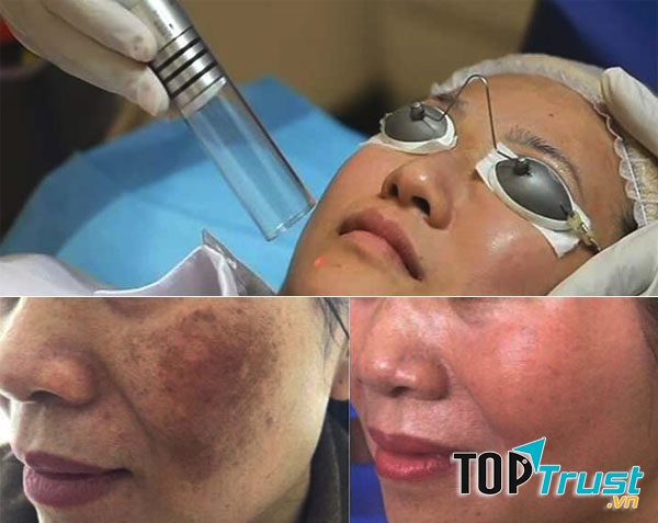 Phòng Khám chuyên khoa da liễu tại Thanh Hóa