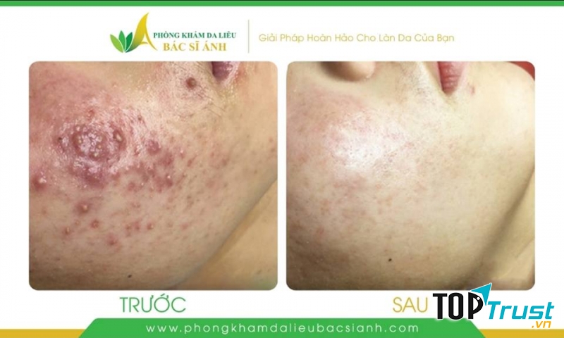 Phòng Khám Chuyên Khoa Da Liễu - Tiến sĩ, Bác sỹ Trần Ngọc Ánh