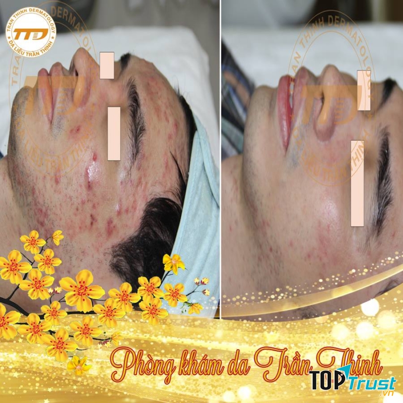 Phòng khám Chuyên khoa da liễu Trần Thịnh