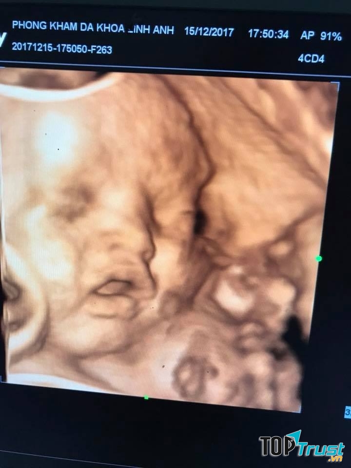 Phòng khám chuyên khoa Linh Anh