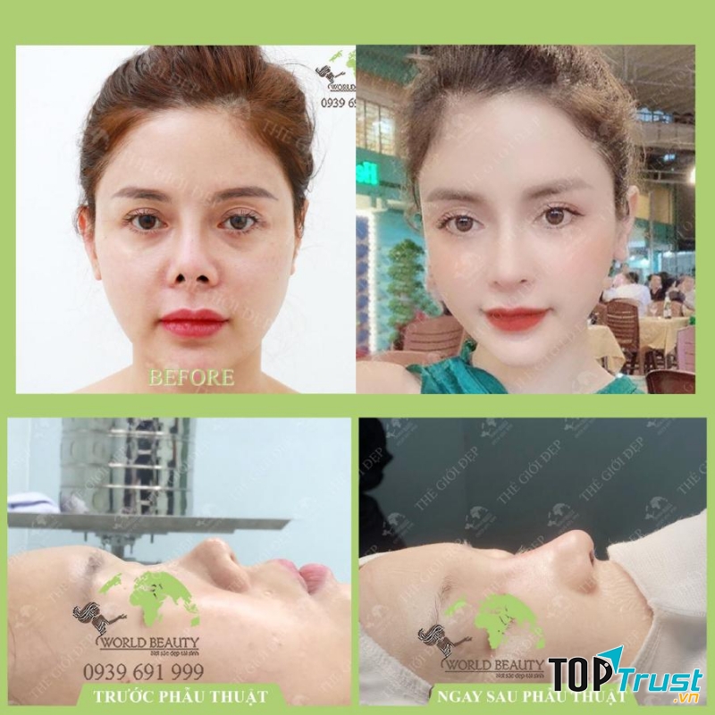 Phòng khám chuyên khoa phẫu thuật thẩm mỹ Thế Giới Đẹp - bác sĩ Nguyễn Văn Phùng