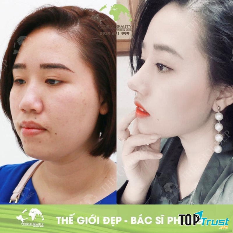 Phòng khám chuyên khoa phẫu thuật thẩm mỹ Thế Giới Đẹp - bác sĩ Nguyễn Văn Phùng