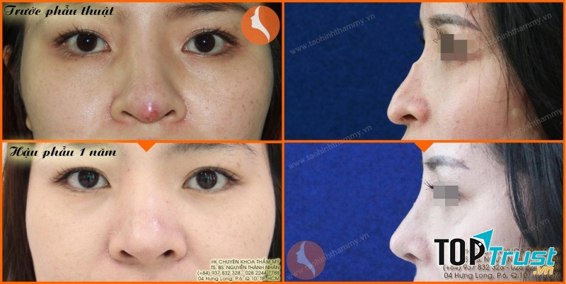 Phòng khám chuyên khoa phẫu thuật thẩm mỹ TS. BS Nguyễn Thành Nhân