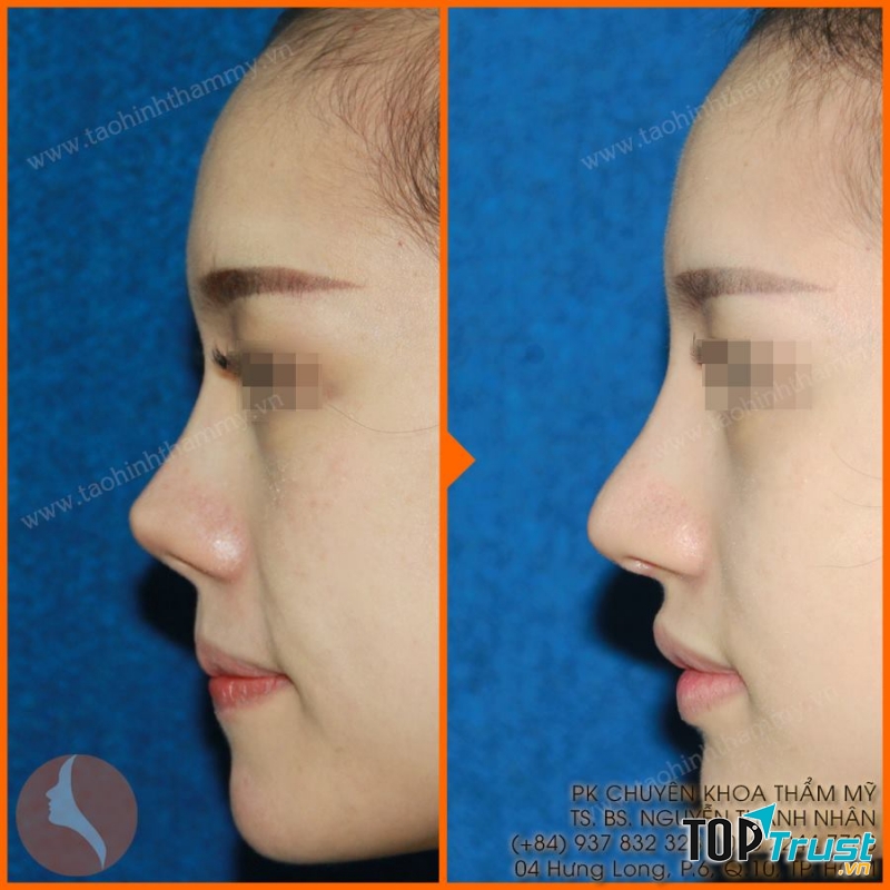 Phòng khám chuyên khoa phẫu thuật thẩm mỹ TS. BS Nguyễn Thành Nhân