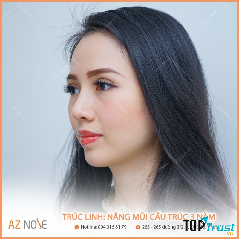 Phòng khám chuyên nâng mũi AZ NOSE