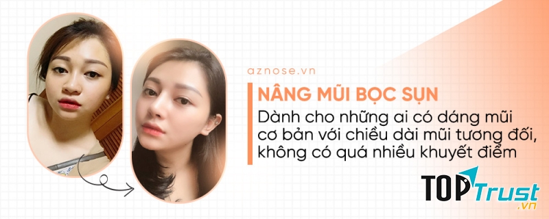 Phòng khám chuyên nâng mũi AZ NOSE - Bác sĩ Nguyễn Hoàng Nam