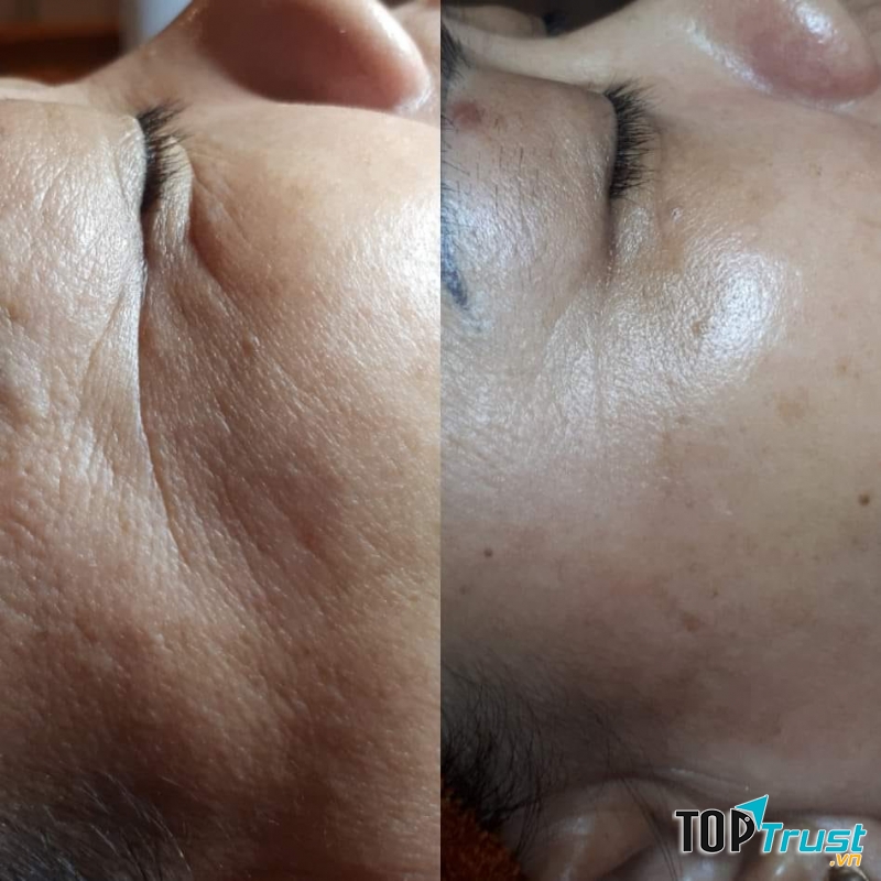 Phòng Khám Da Liễu 11 Hải Thượng Lãn Ông