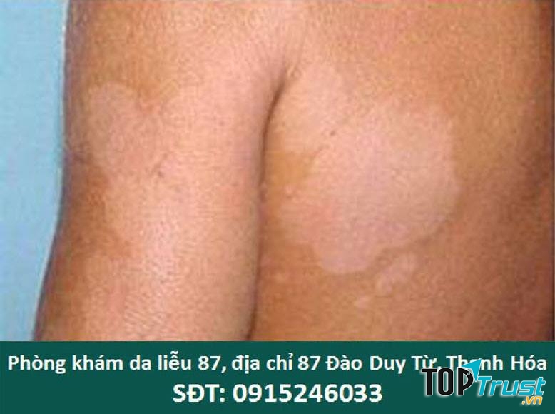 Phòng Khám Da Liễu 87 - Thanh Hóa